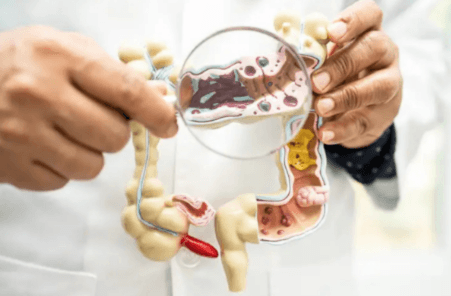 Model anatomic folosit pentru a ilustra digestia și zona intestinală